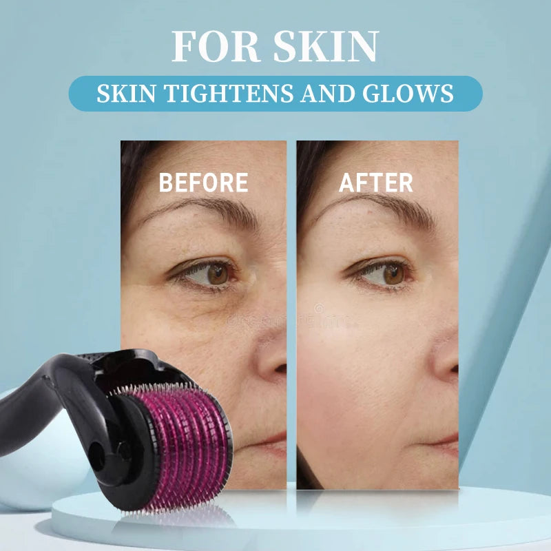 540 Titanium Derma Roller – Collagen Boost, Skin Renewal & Hair Regrowth (0.2–2.5mm)