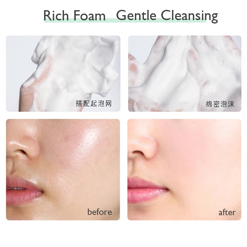 PTWOP Whitening Facial Cleanser – Deep Clean, Oil Control & Pore Care